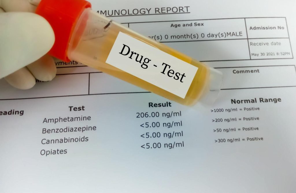 Does Semaglutide Show on a Drug Test?