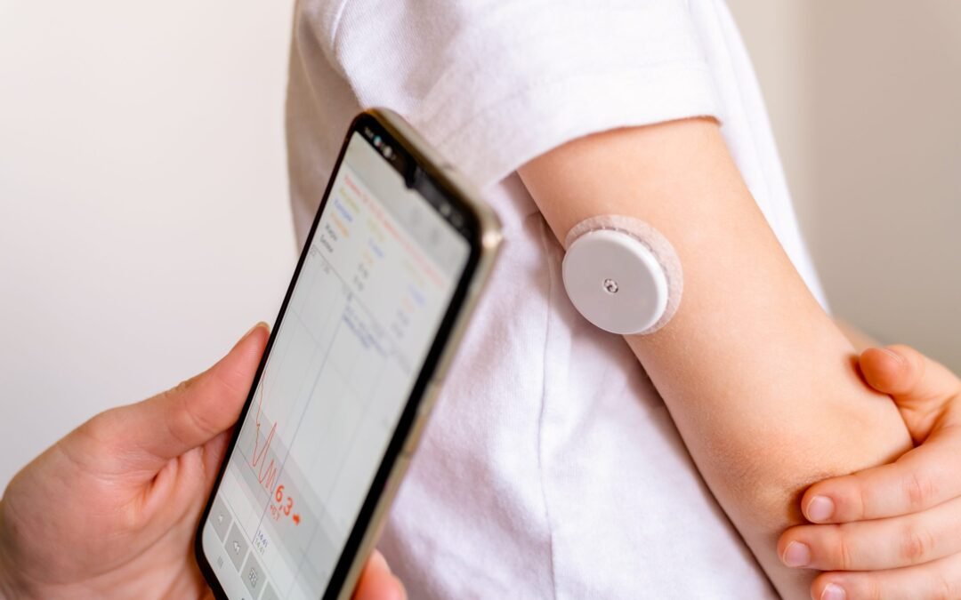 How to Remove a Continuous Glucose Monitor (CGM): A Step-by-Step Guide