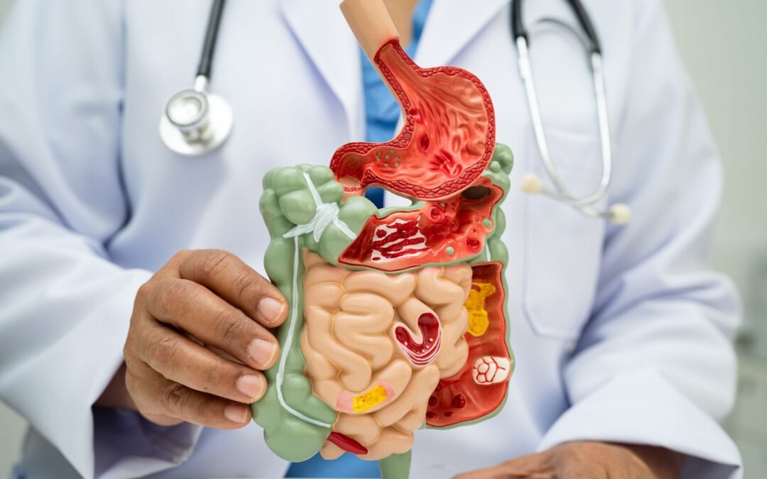 How to Have a Healthy Gut Biome​