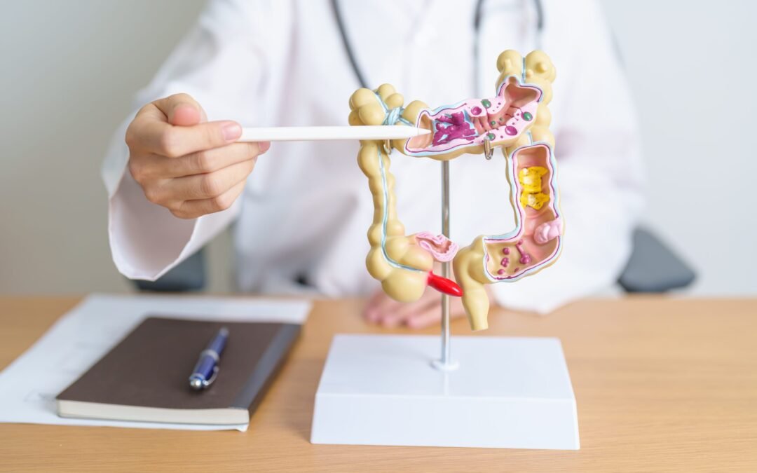 How Gut Biome Affects Weight Loss Success