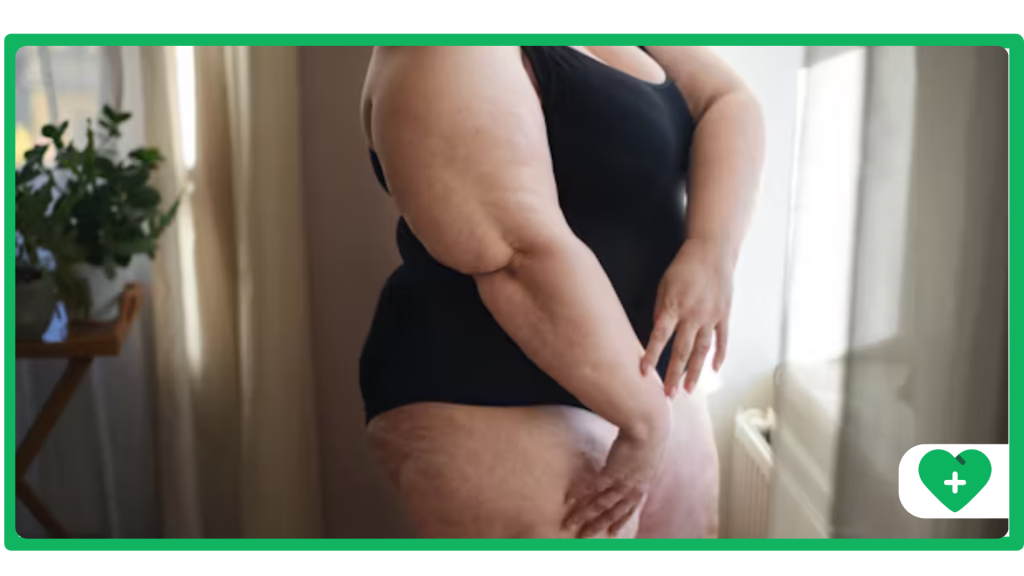 What Does Semaglutide Do to Your Body?