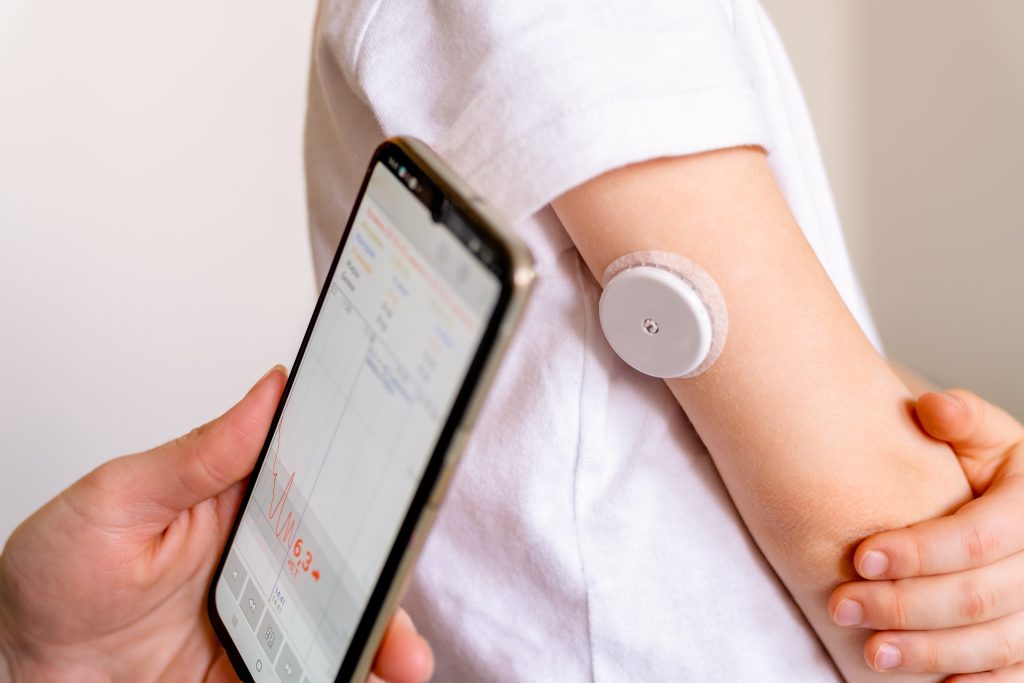 How to Remove a Continuous Glucose Monitor (CGM): A Step-by-Step Guide